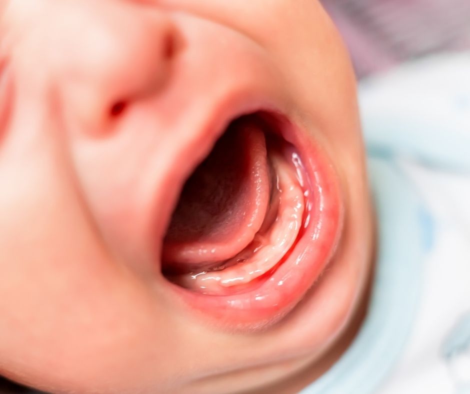 WĘDZIDEŁKO JĘZYKA